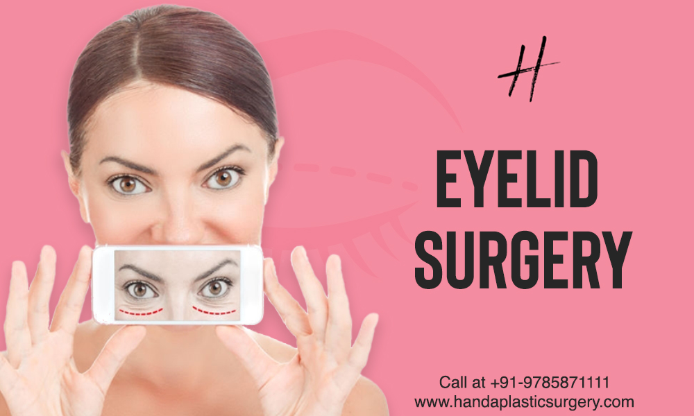 Read more about the article 5 Things You Need to Know About Eyelid Surgery