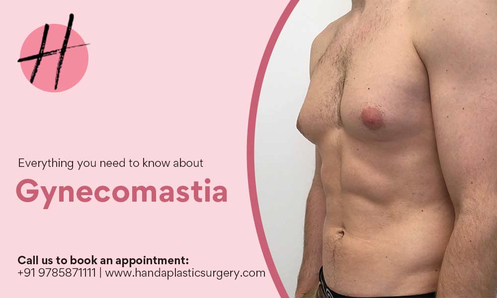 Read more about the article Gynecomastia Symptoms | How Surgery can be helpful?