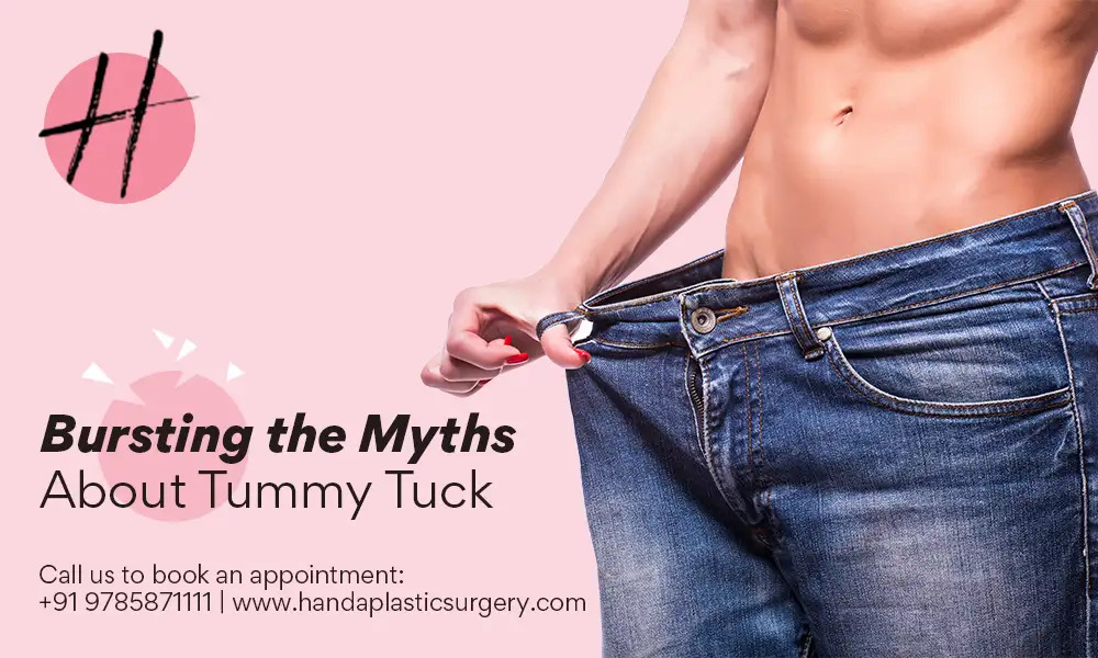 Read more about the article Myths and Facts about tummy tuck surgery