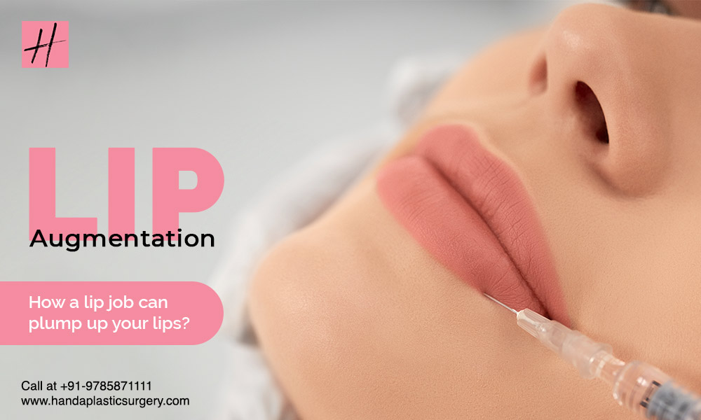 Read more about the article Lip Augmentation: How a lip job can plump up your lips?