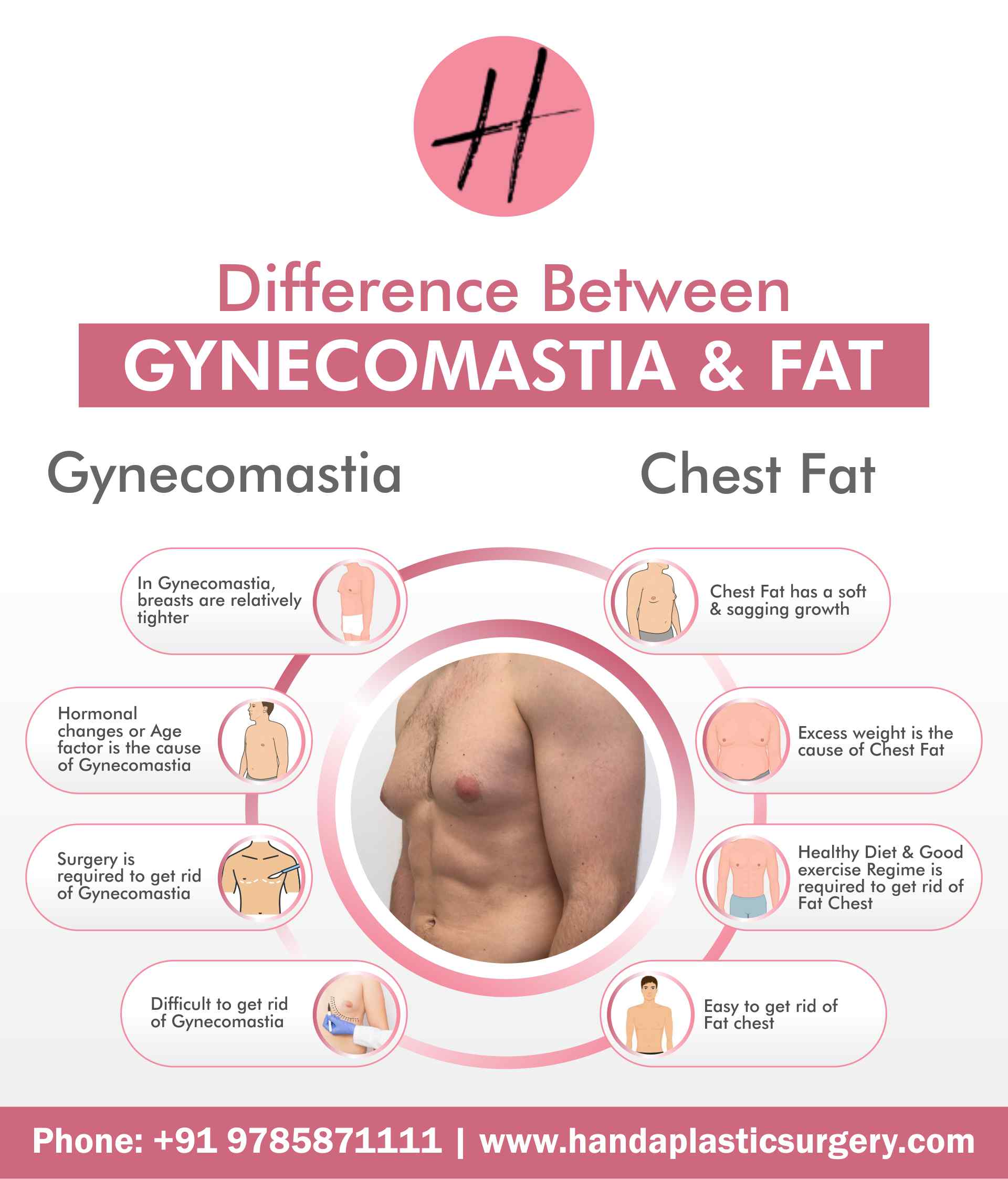 Gynecomastia-vs-chest-fat-what-is-the-difference