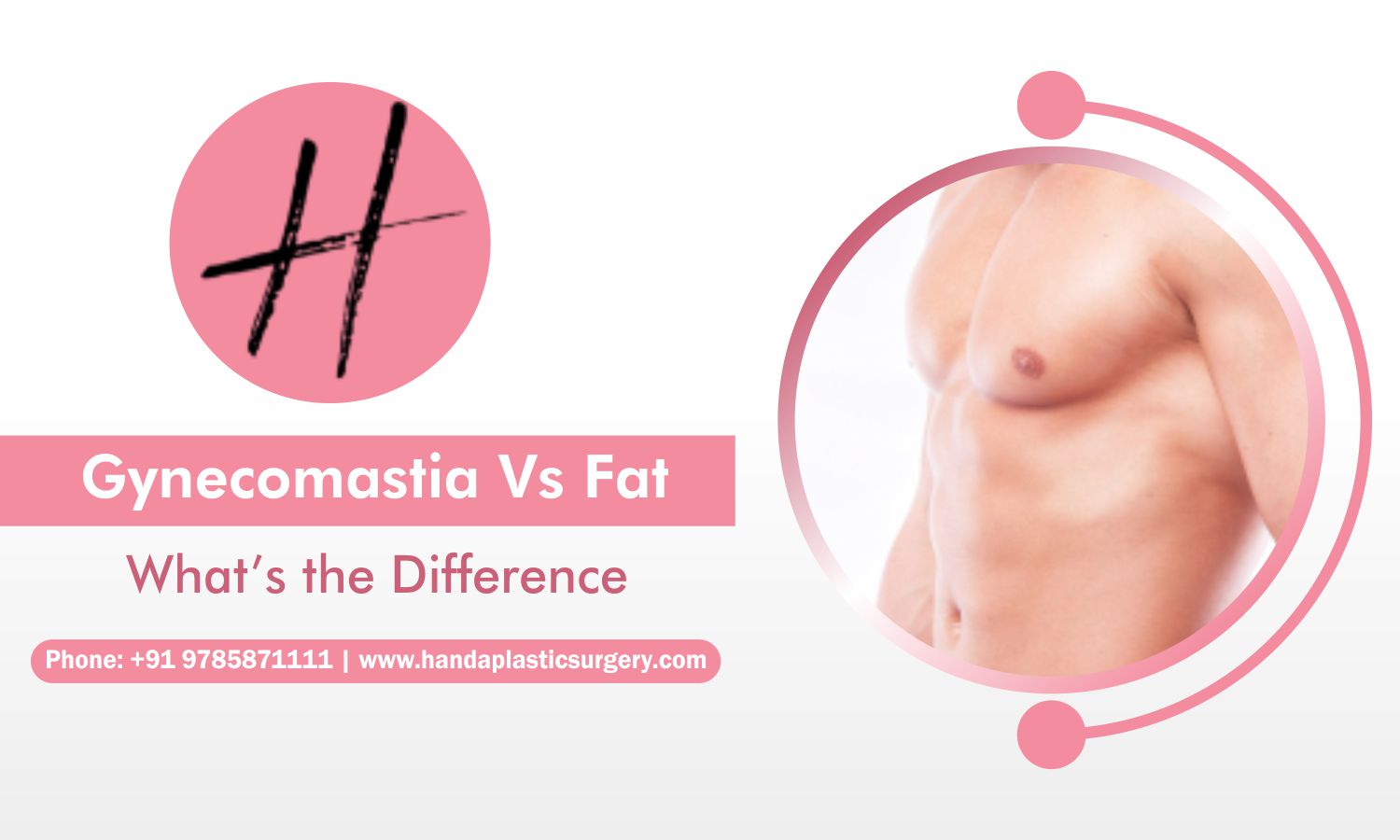Read more about the article Gynecomastia vs Chest fat: What is the difference