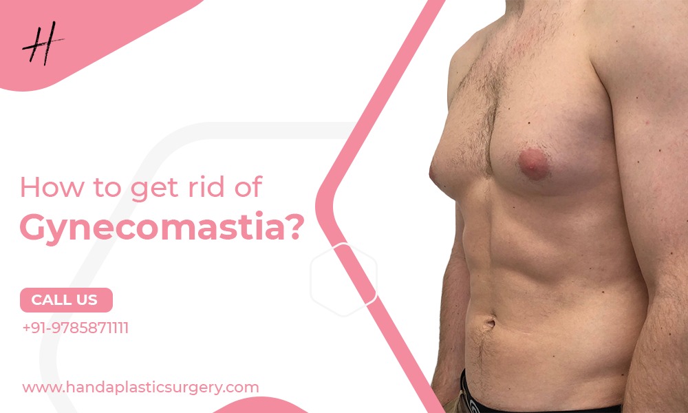 Read more about the article How to get rid of Gynecomastia/Which doctor to consult for gynecomastia