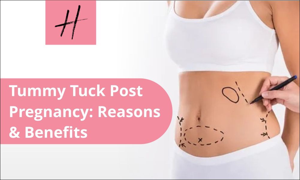 Read more about the article Tummy Tuck Post Pregnancy: Reasons & Benefits