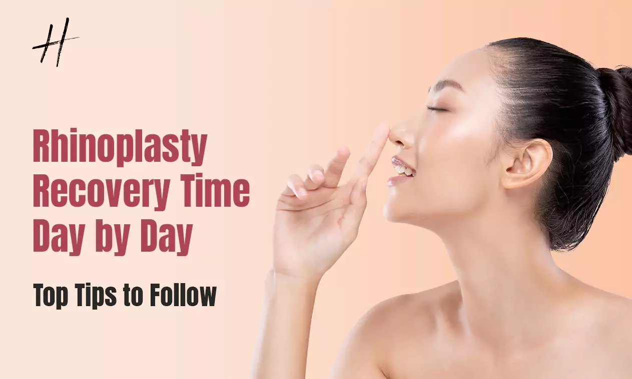 Read more about the article Rhinoplasty Recovery Time Day By Day