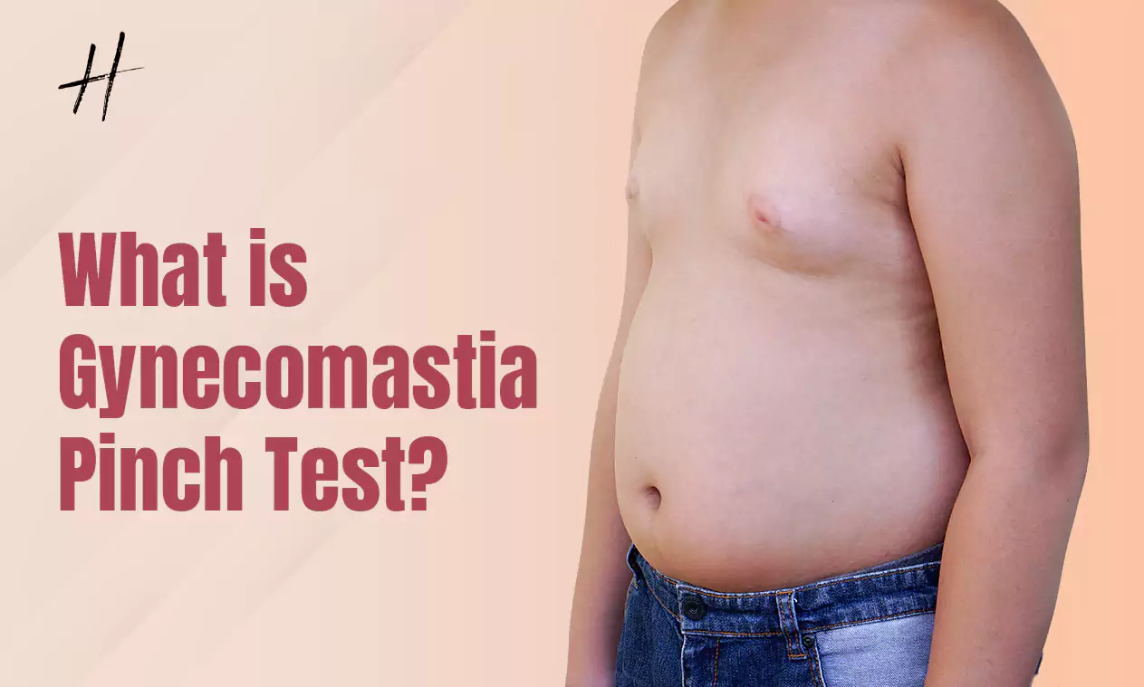 Read more about the article GYNECOMASTIA PINCH TEST – A Comprehensive Guide By Handa Aesthetics
