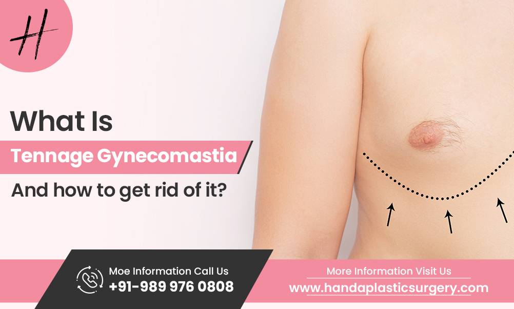 You are currently viewing What Is Teenage Gynecomastia And How TO Get Rid Of It?