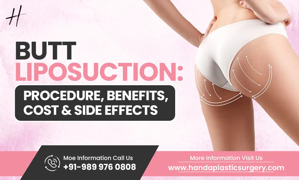 Butt Liposuction: Procedure, Benefits, Cost &amp; Side Effects