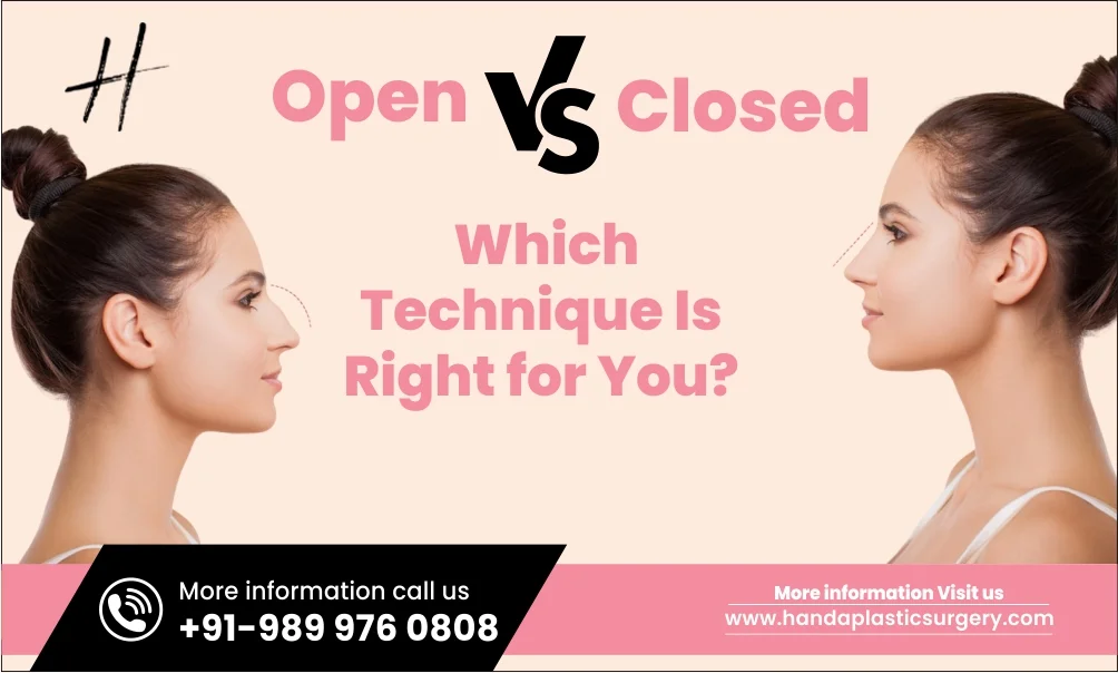 Open vs Closed Rhinoplasty: Which Technique Is Right for You?