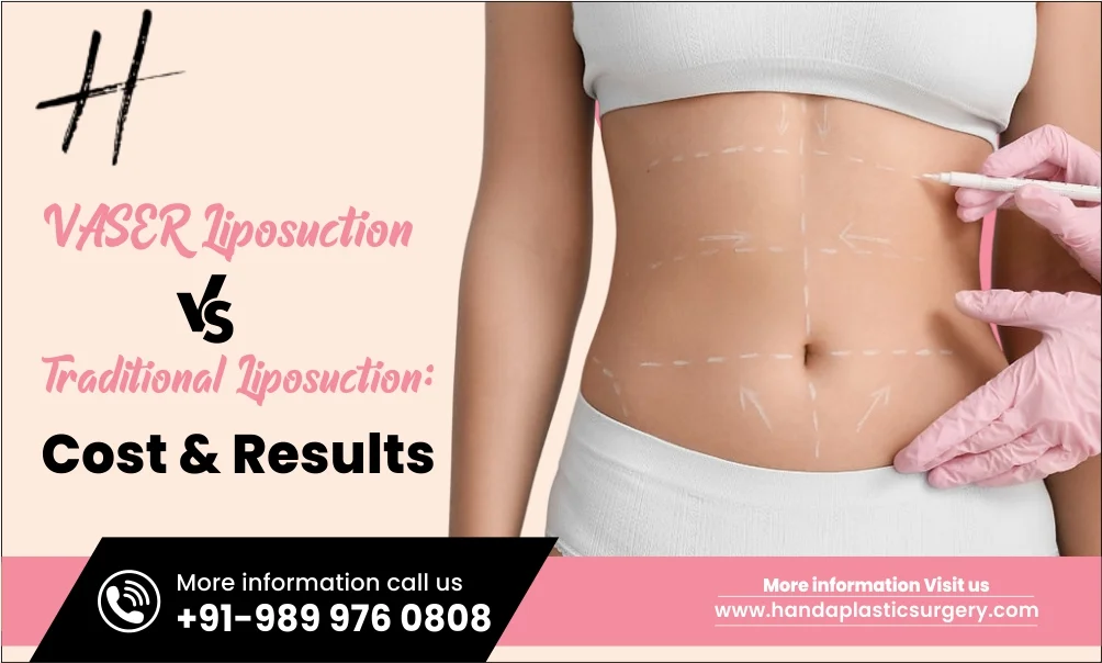 VASER Liposuction vs Traditional Liposuction: Cost & Results