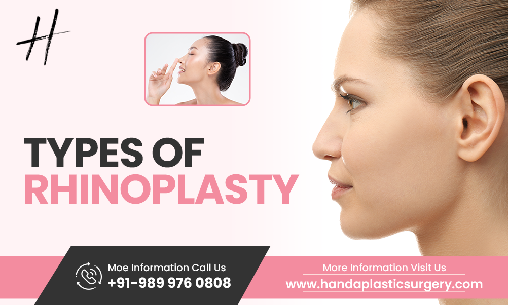 Types Of Rhinoplasty