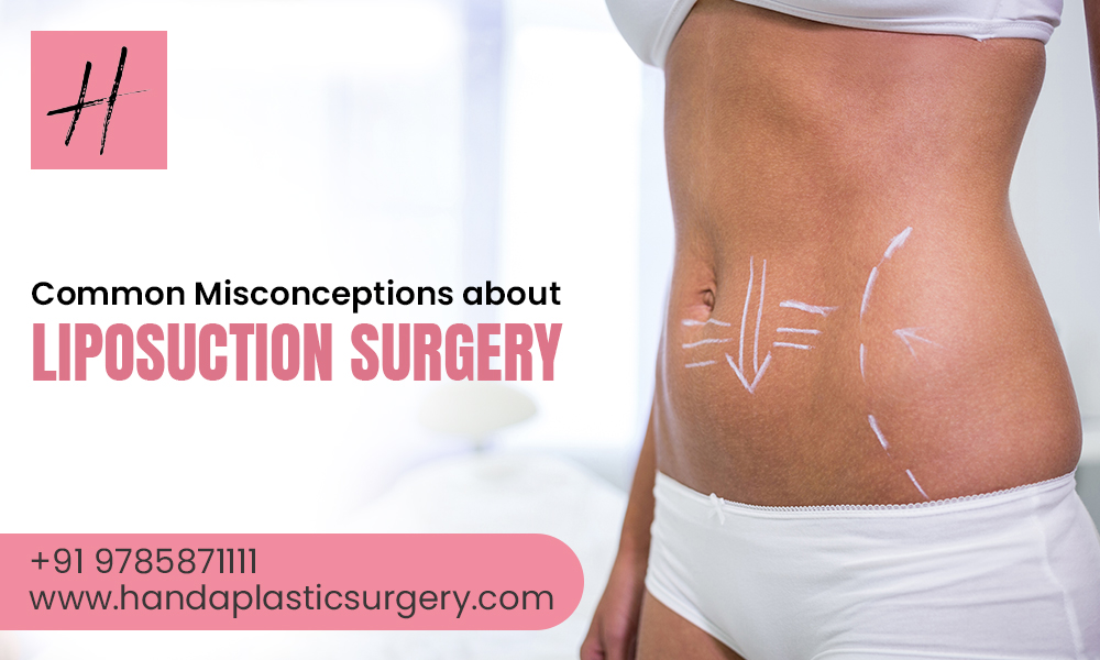 10 Common Misconceptions About Liposuction