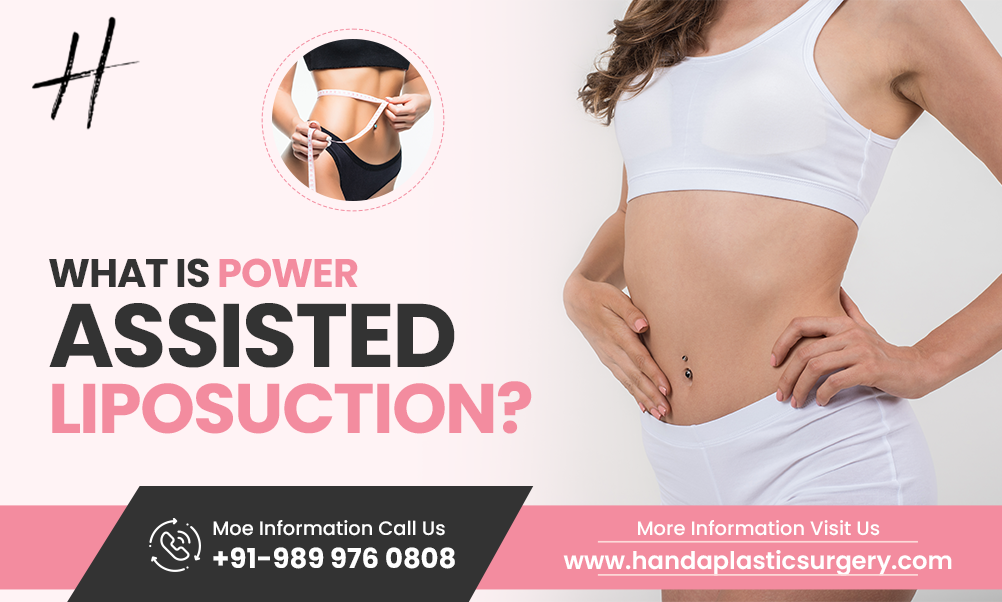 What Is Power-Assisted Liposuction?