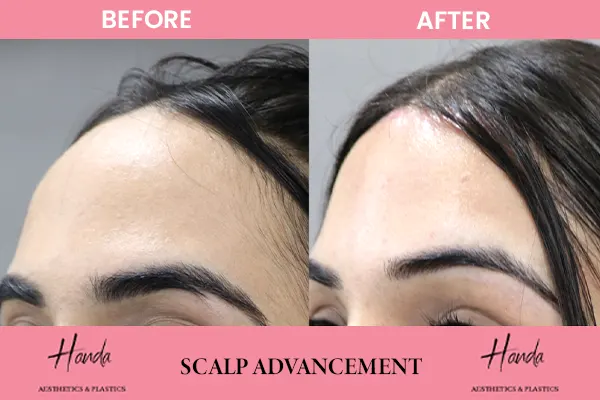 Face before and after — Handa Aesthetics