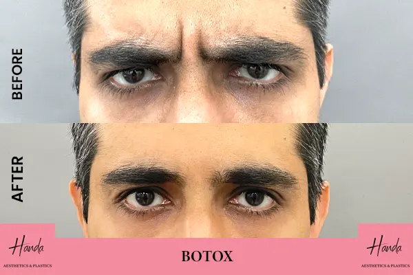 Body Contouring before and after — Handa Aesthetics
