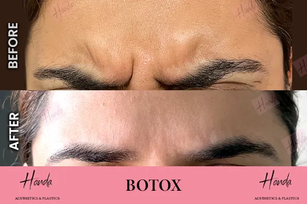 Body Contouring before and after — Handa Aesthetics