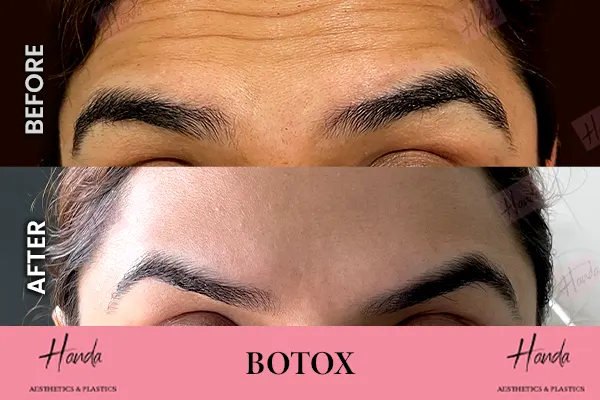 Body Contouring before and after — Handa Aesthetics