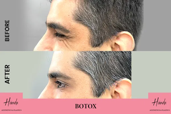 Body Contouring before and after — Handa Aesthetics