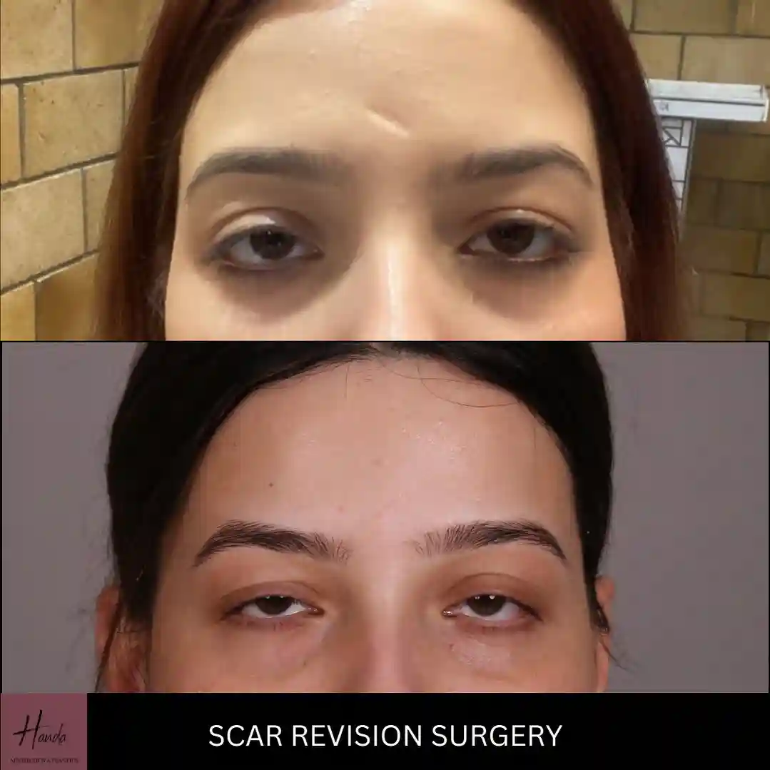 Face before and after — Handa Aesthetics