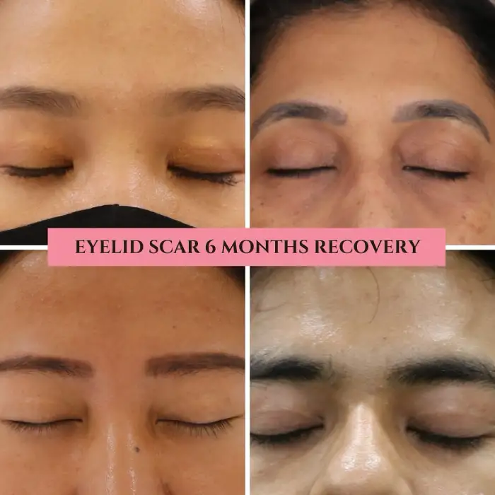 Face before and after — Handa Aesthetics